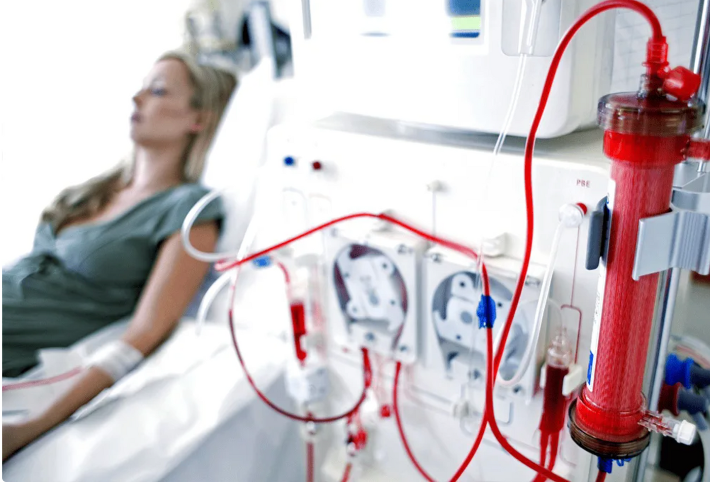 If We Do Not Address Free Radicals, Kidney Function Can Continue to Decline